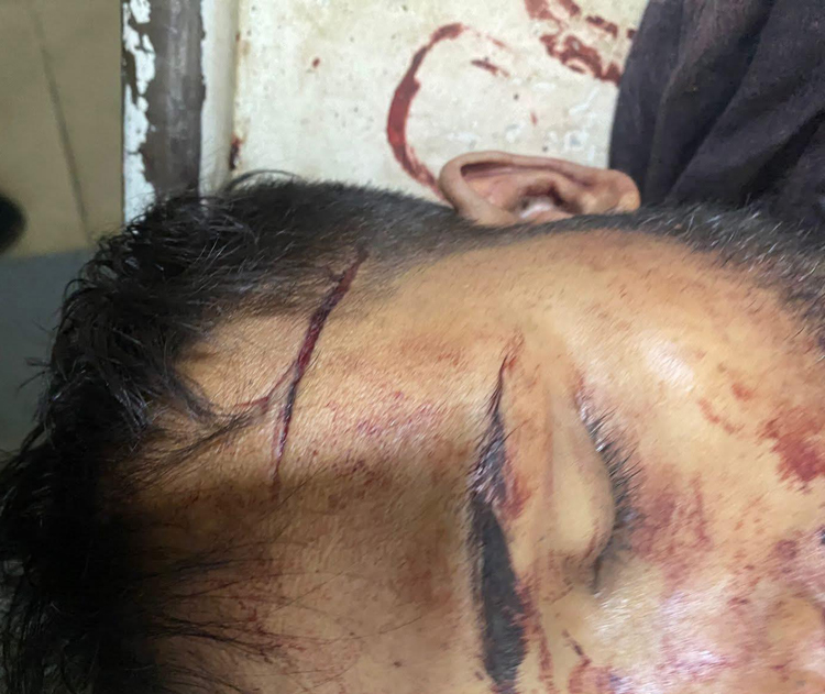 জকিগঞ্জে শিবির কর্মীকে কুপিয়ে  হত্যার অভিযোগ